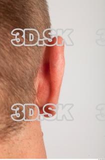 Ear texture of Gene 0003